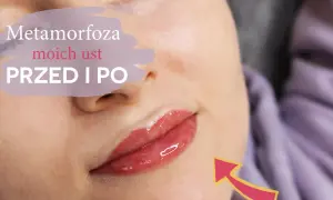 Makijaż permanentny ust czy warto? Odkryj zalety i wady tej metody